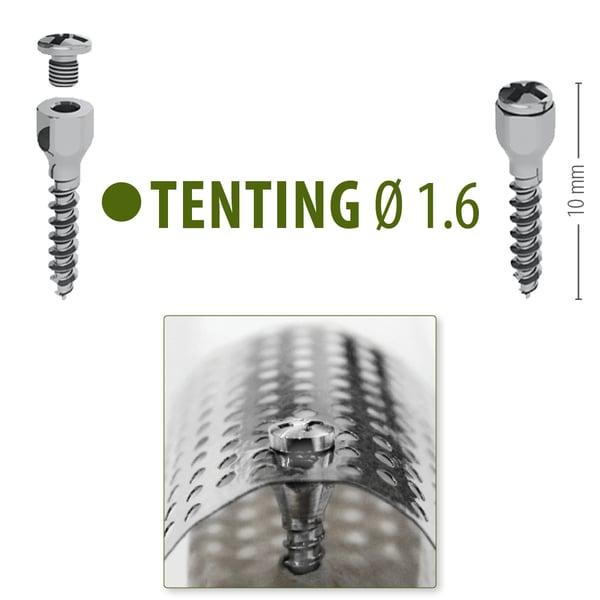 Citagenix Titanium Tenting Screws